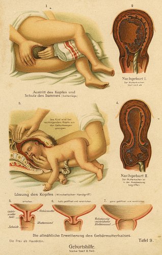 医学の図版／ドイツ・1900年頃