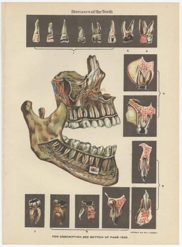 ؤοǡDiseasea of the Teethסʥꥫ1920ǯ