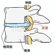 ڥåաŹĹǴĥإ˥ˡɤмΤ