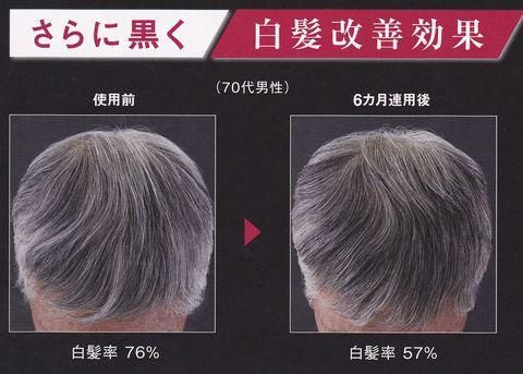 アデノバイタル スカルプエッセンス V 通販サロンマキ オーガニックシャンプーヘアケア通販