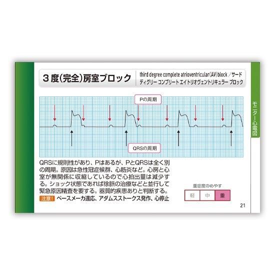 m*m様 実力心電図　改訂版 実力心電図: 「読める」のその先へ | 日本不整脈心電学会 |本