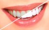 Teeth Whitening/歯のホワイトニング