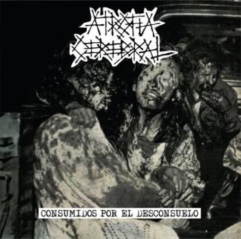 ATROFIA CEREBRAL 