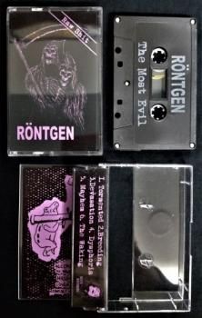 RONTGEN 