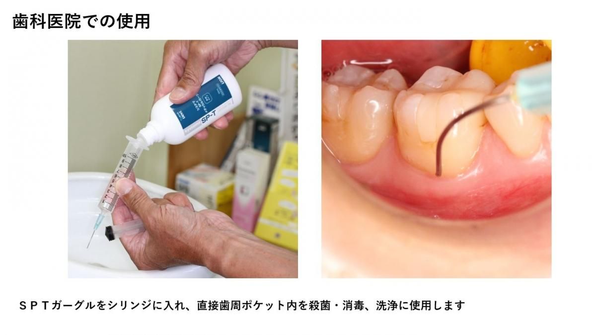 口腔ケアセット (145g) - FFラボ