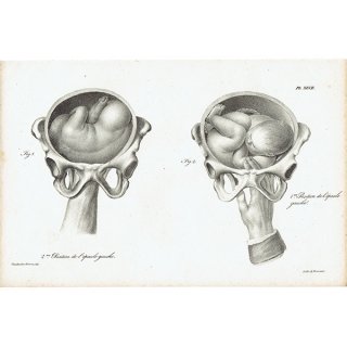 解剖学 胎児 リトグラフ フランスアンティークプリント  0001