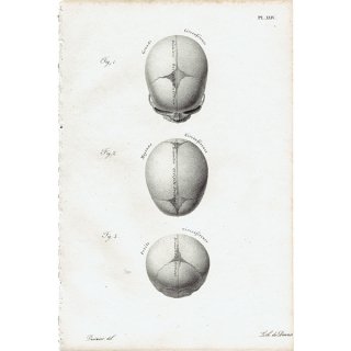 解剖学 胎児の頭蓋骨 リトグラフ フランスアンティークプリント  0002