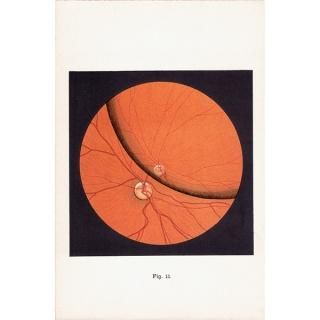 解剖学 Anatomyのアンティークプリント - アンティークプリント