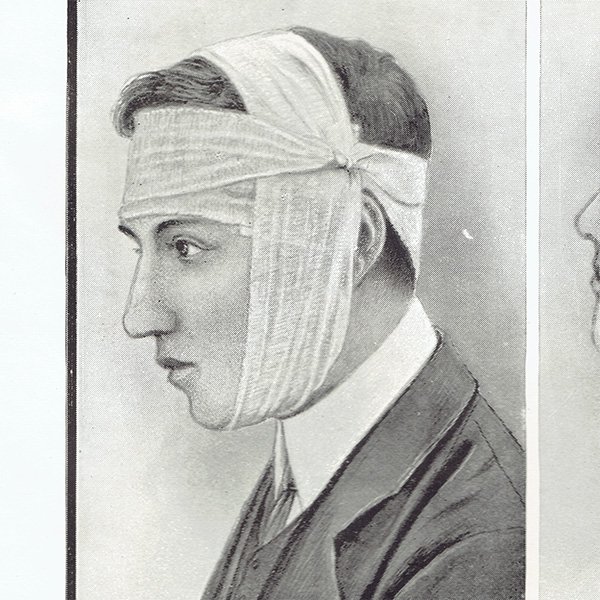 ミセスビートンの家政読本 看護 包帯の巻き方（頭） 医療系 1906年 イギリスアンティークプリント 0051