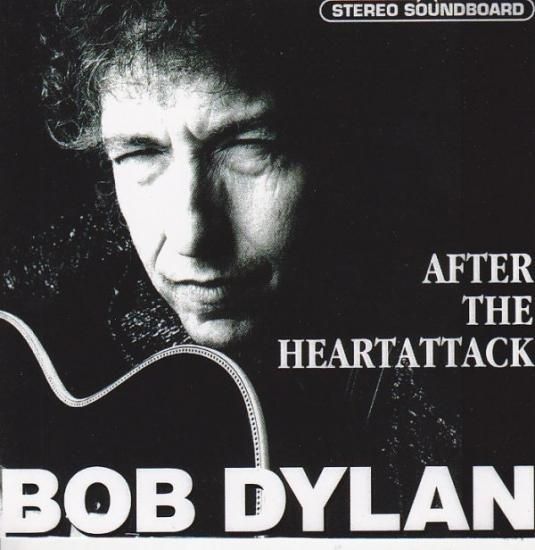ボブ・ディラン After The Heartattack Volume II BOB DYLAN / AFTER THE HEARTATTACK 2