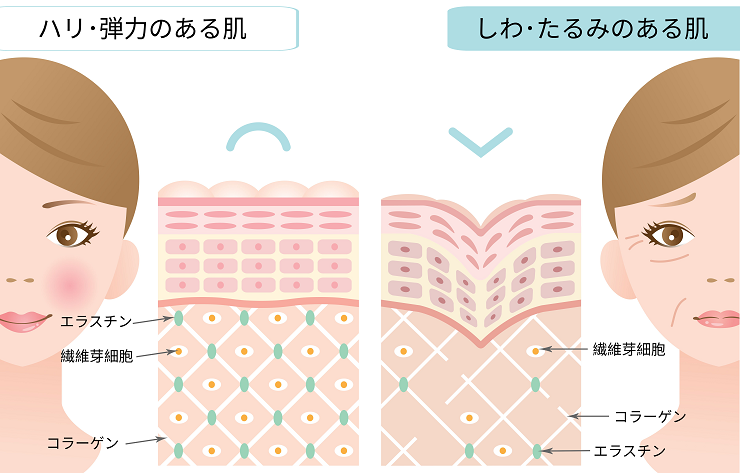 錄