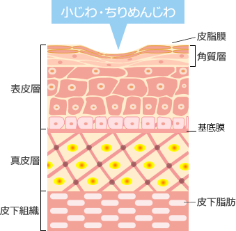 小じわ