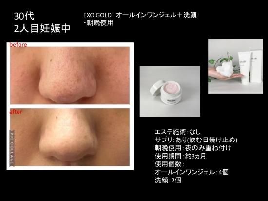 EXO GOLD ALL IN ONE GEL 50g - NATURA.公式オンラインショップ