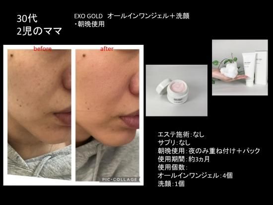 EXO GOLD ALL IN ONE GEL 50g - NATURA.公式オンラインショップ