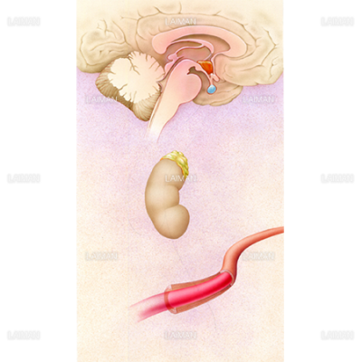 視床下部 脳下垂体 副腎 鬱病について Sサイズ Laiman Stockweb メディカルイラスト素材のダウンロード販売 視床下部 脳下垂体 副腎 鬱病について Sサイズ Laiman Stockweb メディカルイラスト素材のダウンロード販売
