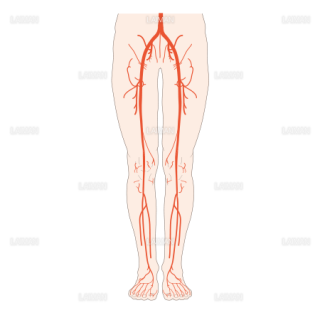 下肢の動脈閉塞の好発部位 （Sサイズ）