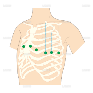 標準12誘導法／単極胸部誘導 （Sサイズ）