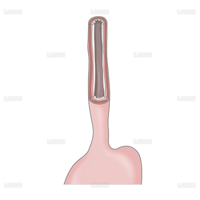 食道 Laiman Stockweb メディカルイラスト素材のダウンロード販売 食道 Laiman Stockweb メディカルイラスト素材のダウンロード販売