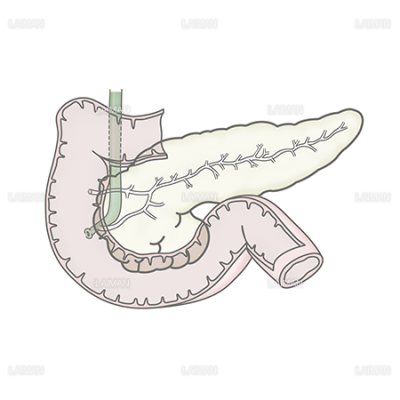 膵臓と十二指腸 Laiman Stockweb メディカルイラスト素材のダウンロード販売
