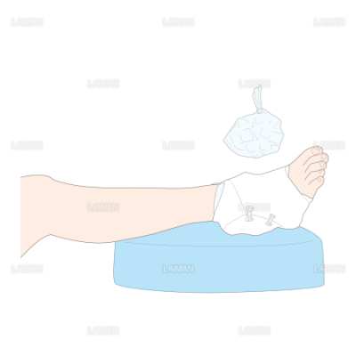 Rice処置 mサイズ Laiman Stockweb メディカルイラスト素材のダウンロード販売 Rice処置 mサイズ Laiman Stockweb メディカルイラスト素材のダウンロード販売