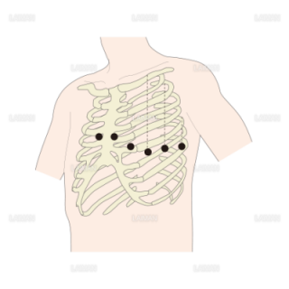 電極位置（単極胸部誘導） （Ｍサイズ）
