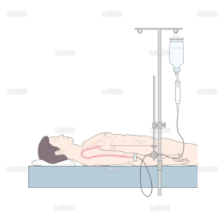 中心静脈圧（CVP）測定法 （Ｍサイズ）