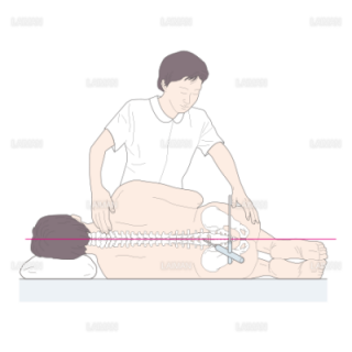 腰椎穿刺時の体位と介助の仕方 （Ｍサイズ）