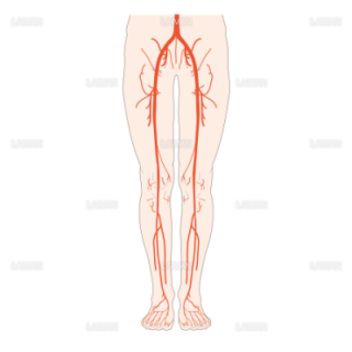 下肢の動脈閉塞の好発部位 （Ｍサイズ）