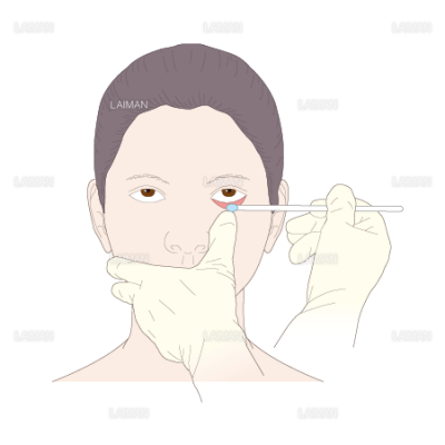 眼軟膏の塗布 Sサイズ Laiman Stockweb メディカルイラスト素材のダウンロード販売 眼軟膏の塗布 Sサイズ Laiman Stockweb メディカルイラスト素材のダウンロード販売