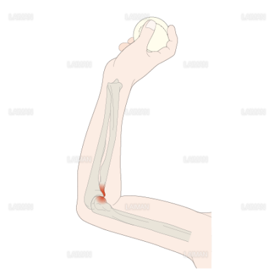 野球ひじ Sサイズ Laiman Stockweb メディカルイラスト素材のダウンロード販売