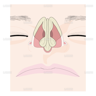 鼻を構成する鼻軟骨（Sサイズ）