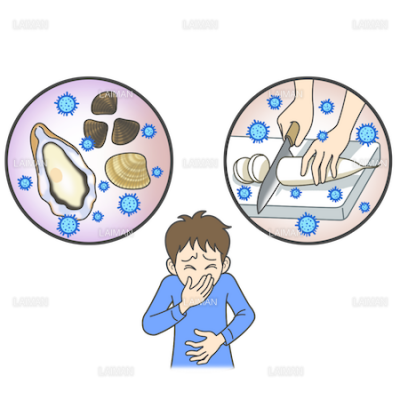 患者イラスト ノロウイルス ウイルス性食中毒 ｍサイズ Laiman Stockweb メディカルイラスト素材のダウンロード販売