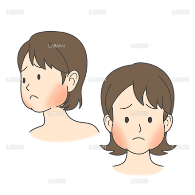 患者イラスト おたふく風邪 流行性耳下腺炎 mサイズ Laiman Stockweb メディカルイラスト素材のダウンロード販売 患者イラスト おたふく風邪 流行性耳下腺炎 mサイズ Laiman Stockweb メディカルイラスト素材のダウンロード販売