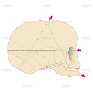 新生児の頭蓋骨計測（側面）（Sサイズ）