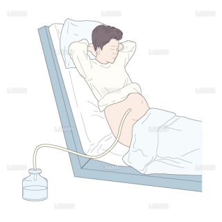 腹腔穿刺時の体位-半座位・坐位（Sサイズ）
