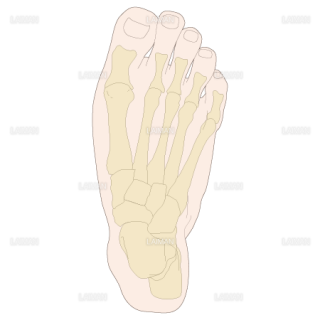 足部のアライメント　外転足（Sサイズ）