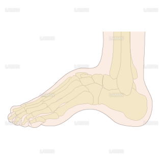足部のアライメント　凹足（Sサイズ）