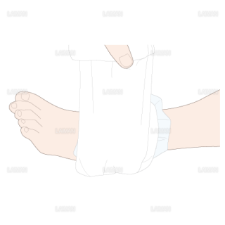 足関節内反捻挫の際のRICE処置　圧迫を加えながらバンテージを巻く（Sサイズ）