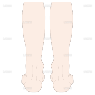 下腿のアライメント　正常（Ｍサイズ）