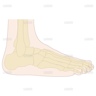 足部のアライメント　扁平足（Ｍサイズ）