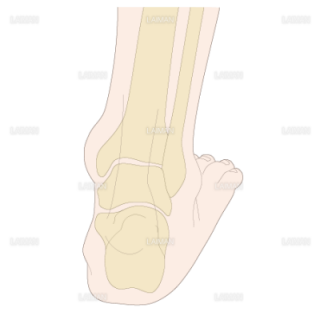 足部のアライメント　外反扁平足（Ｍサイズ）