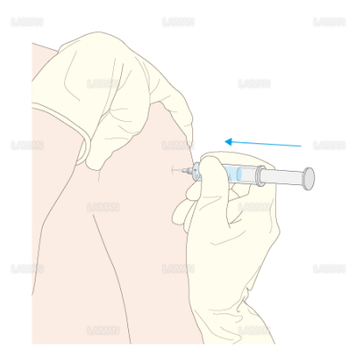 筋肉内注射 Sサイズ Laiman Stockweb メディカルイラスト素材のダウンロード販売