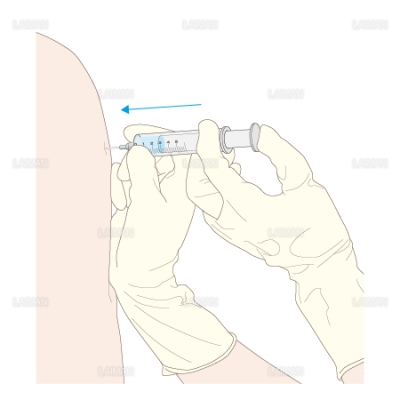 筋肉内注射 Sサイズ Laiman Stockweb メディカルイラスト素材のダウンロード販売