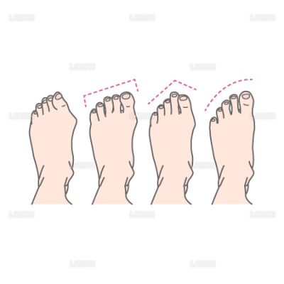 足指の形 ｍサイズ Laiman Stockweb メディカルイラスト素材のダウンロード販売