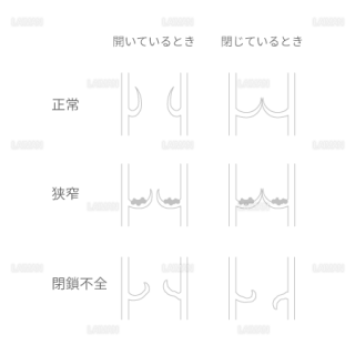 循環器系 Laiman Stockweb メディカルイラスト素材のダウンロード販売 循環器系 Laiman Stockweb メディカルイラスト素材のダウンロード販売