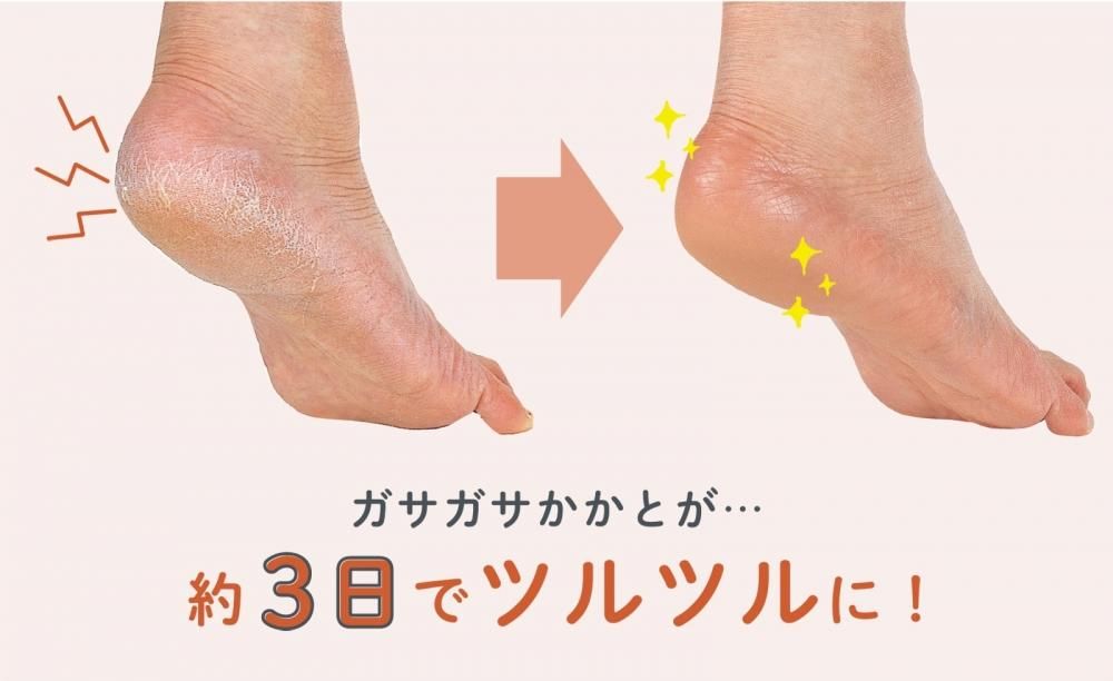 ガサガサかかとが約3日間でツルツルに 足うら美人 潤いサポーター 山忠日和