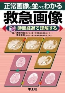 ¤٤Ƥ狼ߵ޲ַв򤹤 [Tankobon Hardcover] ,  and ɼ, 