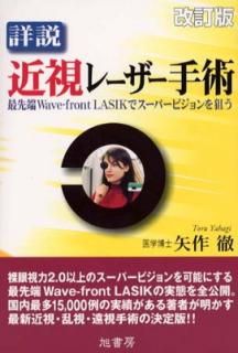 š۾졼 : üWave-front LASIKǥѡӥ