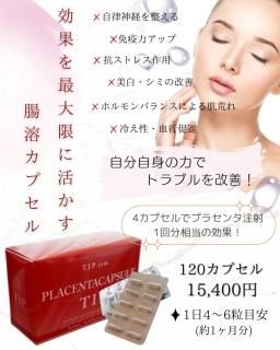 TIPץ饻󥿥ץ