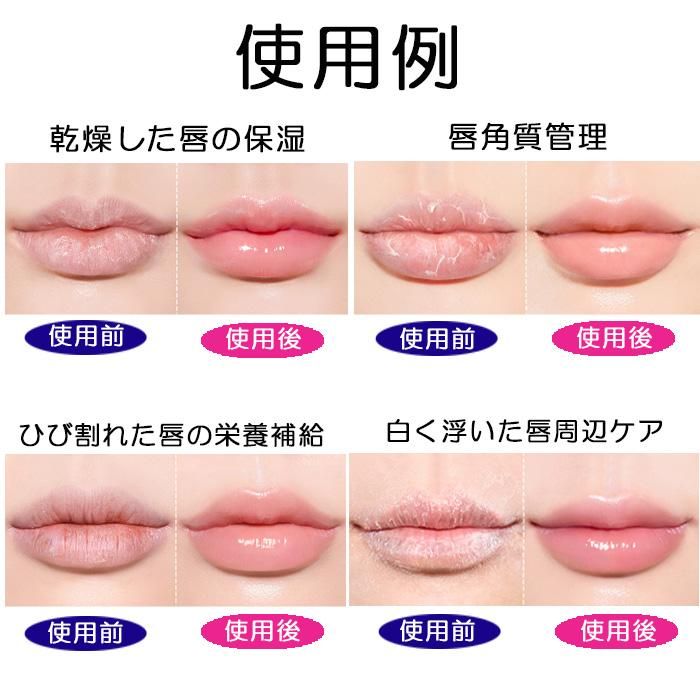 ブリンチュ リップパッチ リップパック 唇パック ぷるぷるの唇へ